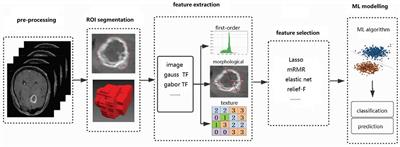 Application of Artificial Intelligence in Diagnosis of Craniopharyngioma